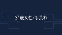 【31歳女性】3ヶ月目に入って手荒れは8割、黄砂アレルギーは9割改善した。