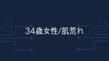 【34歳女性】1ヶ月経って肌質が良くなっているし、ニキビもできなくなっている。